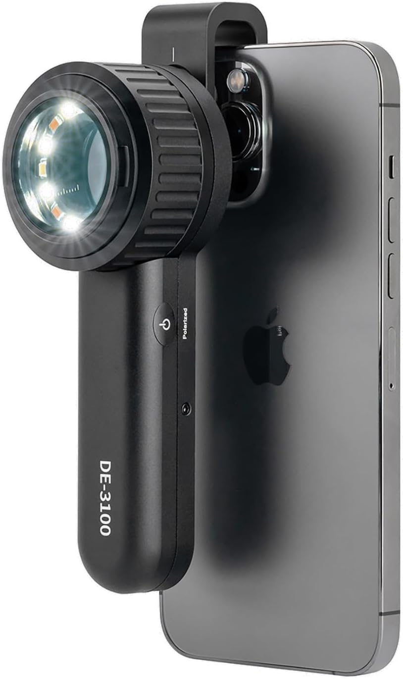 IBOOLO DE-3100 Dermatoscope