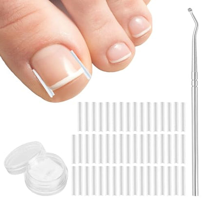 51-Piece Professional Ingrown Toenail Relief Kit with Tools