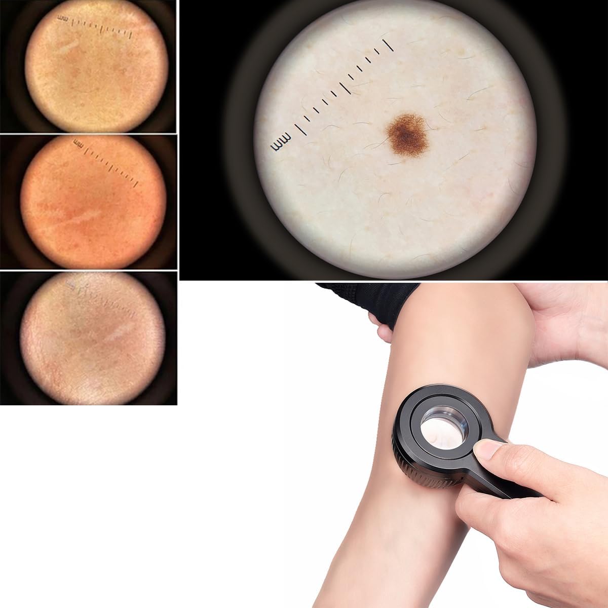 IBOOLO DE-3100 Dermatoscope 