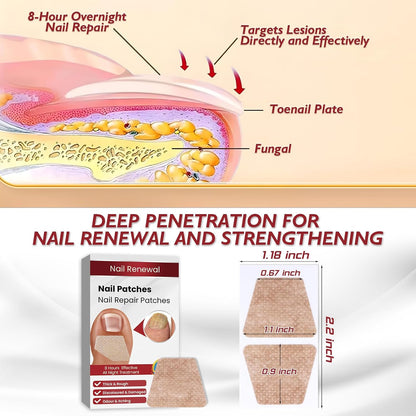 Extra Strength Toenail Fungus Treatment 