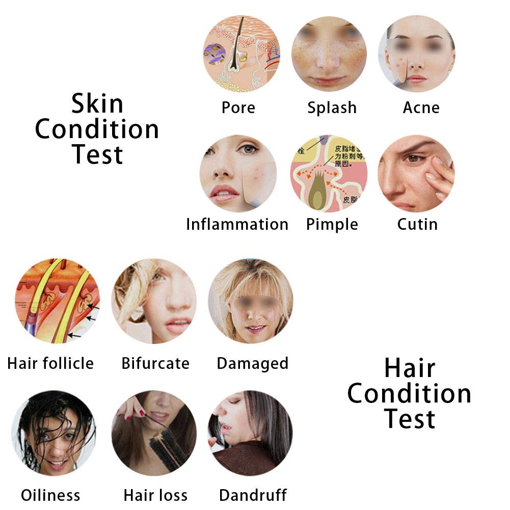 Digital Skin Health Detection for Home Salon
