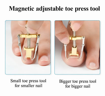 Pedicure Pro Ingrown Nail Corrector 