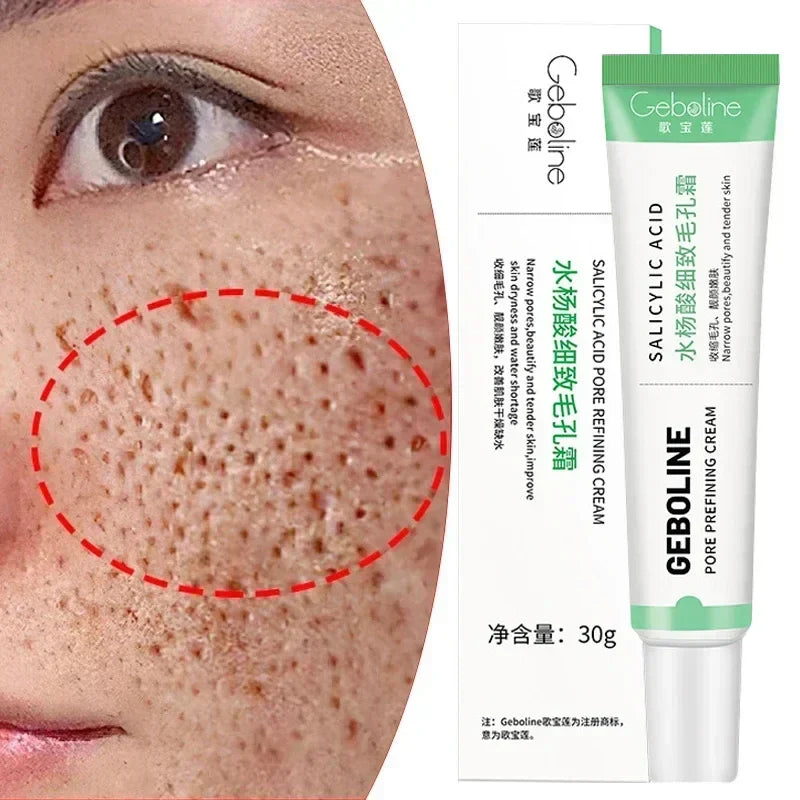 Salicylic Acid Pore Shrinking Cream – Quick Blackhead Removal & Skin Tightening for Smooth, Radiant Skin