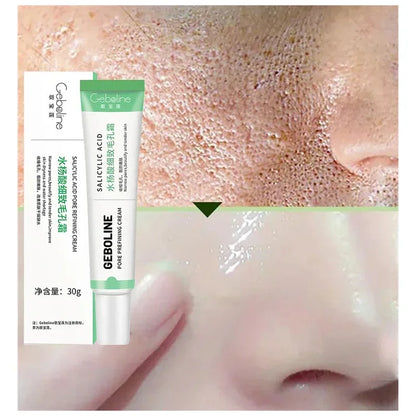 Salicylic Acid Pore Shrinking Cream – Quick Blackhead Removal & Skin Tightening for Smooth, Radiant Skin