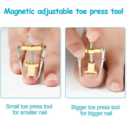 Pedicure Pro Ingrown Nail Corrector