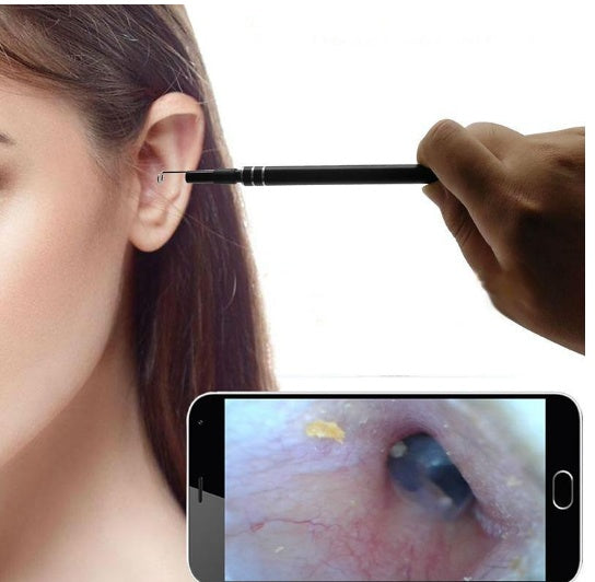 endoscope ear tool